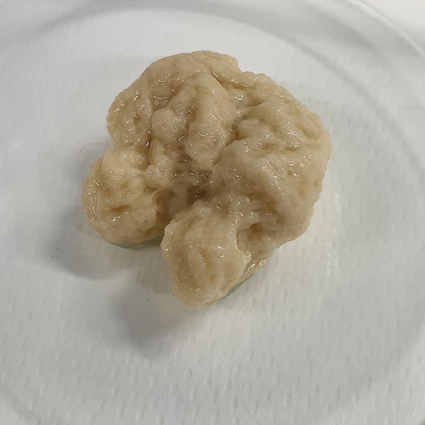 Última hora: ‘sin Gluten’: Cuando la Vida, Como la Cocina, Necesita Segundas Oportunidades